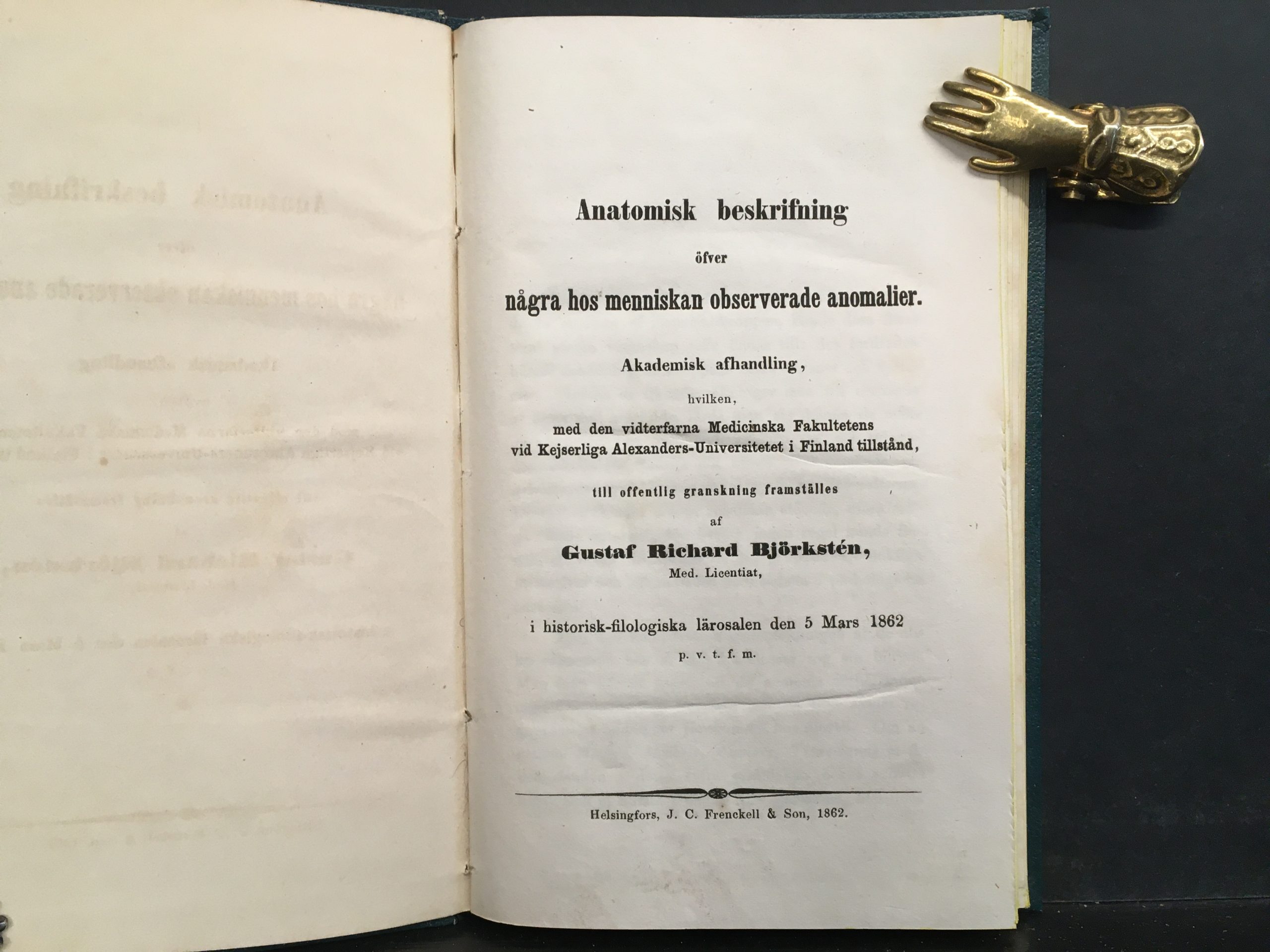 Björkstén, Gustaf Richard: Anatomisk beskrifning öfver några hos menniskan observerade anomalier - Image 2
